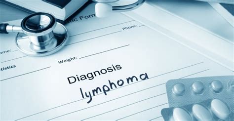 How is Lymphoma Diagnosed? - Facty Health