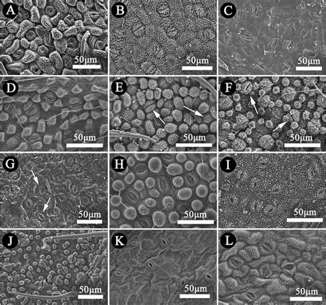 Leaf lower epidermis of Lauraceae under scanning electron microscope... | Download Scientific ...