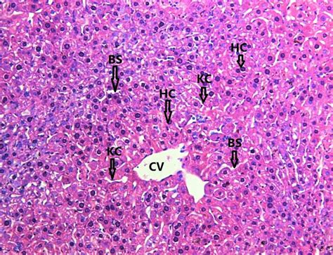 Liver Histology Kupffer Cells