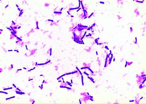 Gram stain of the positive anaerobic blood culture bottle showing... | Download Scientific Diagram