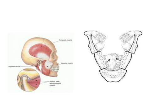 Mandible fracture | PPT