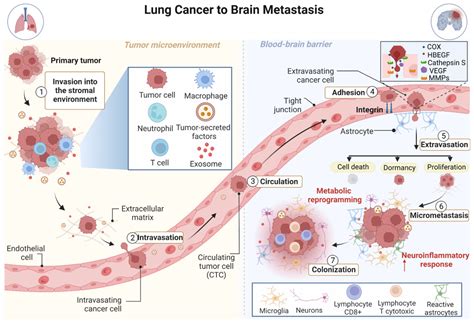 Advances in the Molecular Landscape of Lung Cancer Brain Metastasis