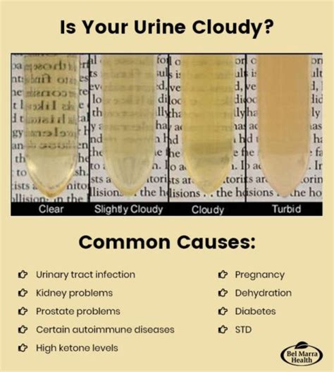 Cloudy Urine