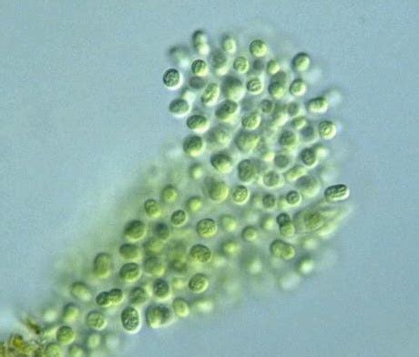 Microcystis is the genus of freshwater cyanobacteria which includes the harmful algal bloom ...