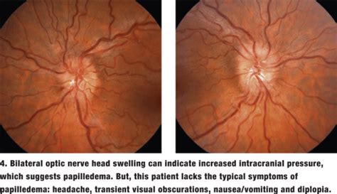 Case Studies in Neuro Disease