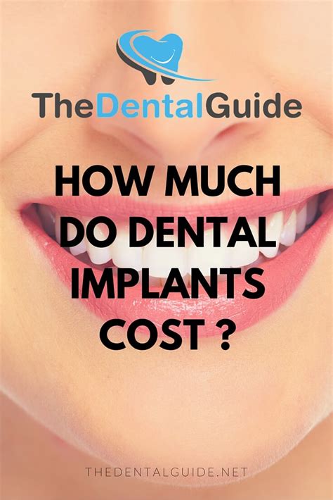 Dental Implants: Costs & Information - The Dental Guide