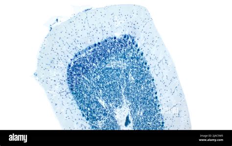 Cerebellum. Purkinje Cells. Cresyl Violet Staining (Nissl Staining Stock Photo - Alamy