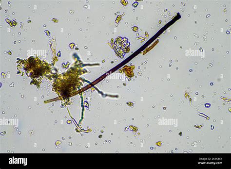 Fungal and fungi hyphae under the microscope in the soil and compost ...