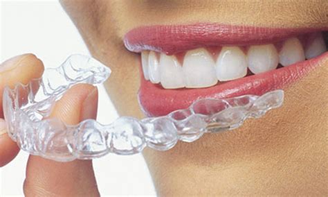 Our Blog - Johnson Orthodontics | Willowbrook Burr Ridge IL