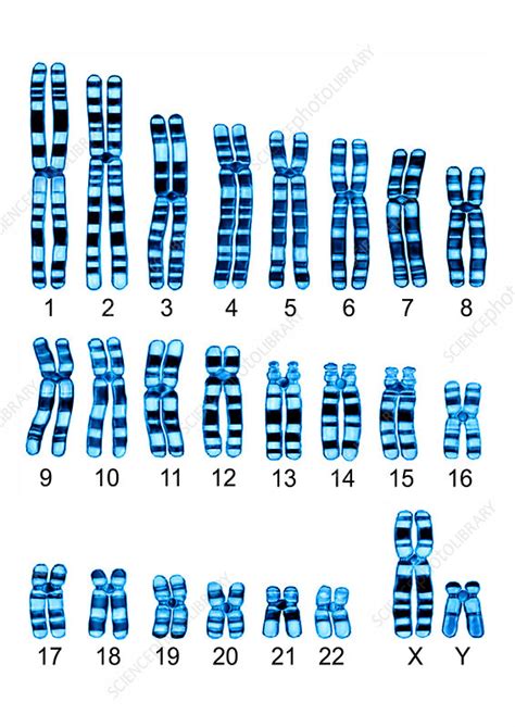 Human Karyotype - Stock Image - C013/0008 - Science Photo Library