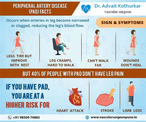 Facts About PAD : PAD occurs when arteries in leg become narrowed or ...