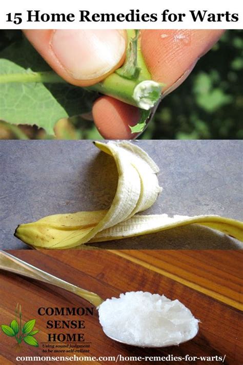 15 Home Remedies for Warts - Easy Home Wart Treatments