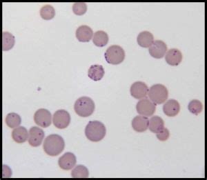 Difference Between Bacteria and Mollicutes | Compare the Difference ...