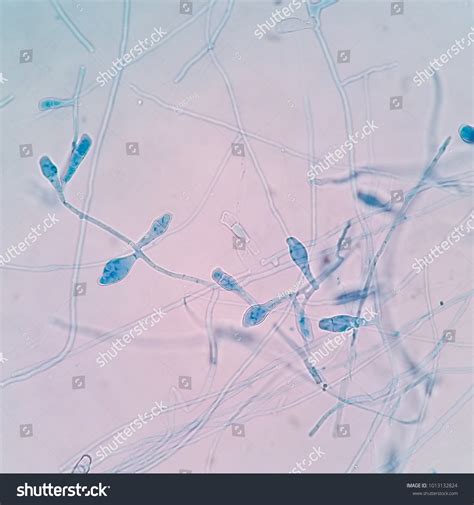 67 Epidermophyton floccosum Images, Stock Photos & Vectors | Shutterstock