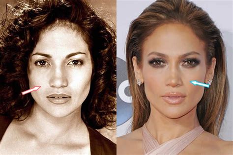 jennifer lopez before and after - Yahoo Image Search Results Plastic ...