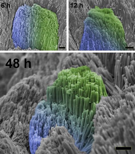 Scientists regrow tooth enamel