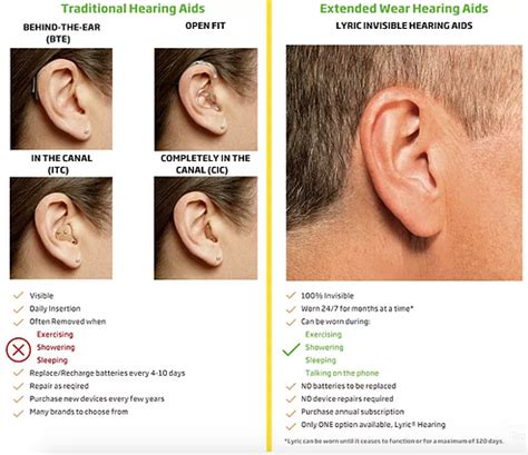 Lyric Hearing Aids: Professional Hearing Center: Audiologists