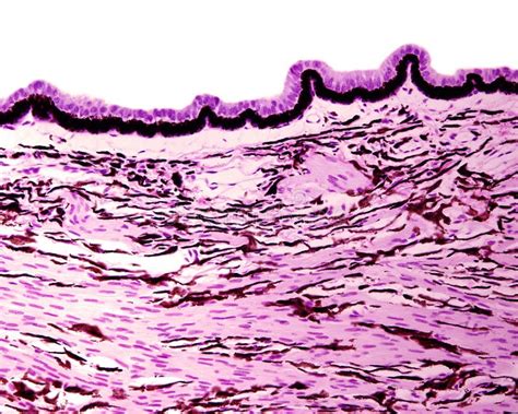 Eye. Ciliary body stock photo. Image of histology, melanin - 303600602