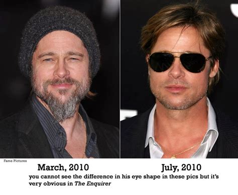 Brad Pitt Botox and Facial Fillers Plastic Surgery Before and After