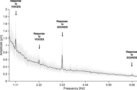 Voice categorization in the four-month-old human brain: Current Biology