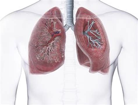 How Long Does Empyema Surgery Take? - Dr.Pramoj