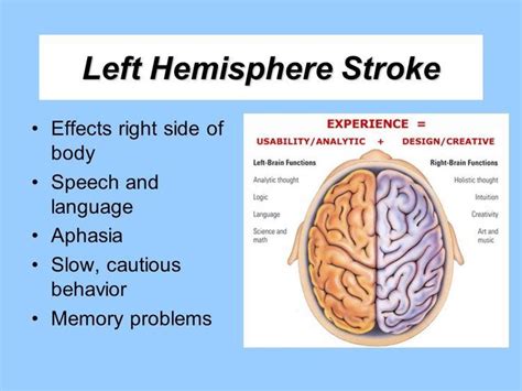 Pin on Strokes: Reasons, Preventions, and Recovery