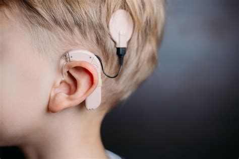 Cochlear Implants Key for Early Intervention - Keck Medicine of USC