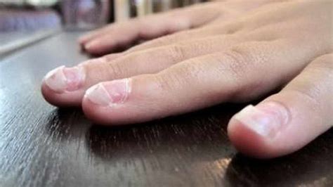 12 Changes In Your Fingernails That Could Signal Other Problems