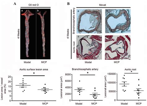 ApoE-/-mice administered with MCP display reduced atherosclerotic ...