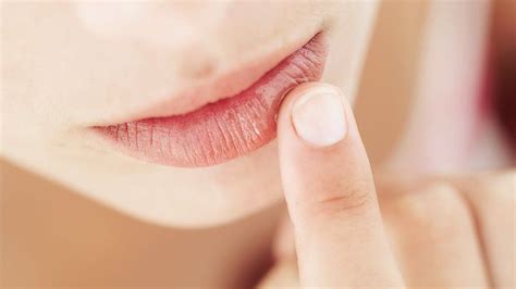 Chapped Lips: Causes, Treatments, and Prevention | Everyday Health