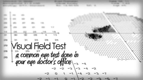 Visual field test for checking side vision