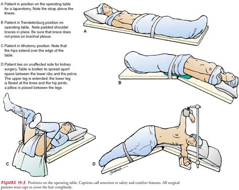 Trendelenburg Position Nursing