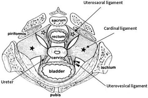 Cardinal Ligament Ureter