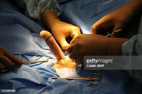 Skin Graft Surgery Photos and Premium High Res Pictures - Getty Images