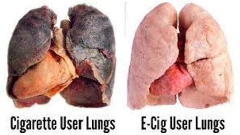 How Long Does It Take for Your Lungs to Heal From Vaping - FactsManiya