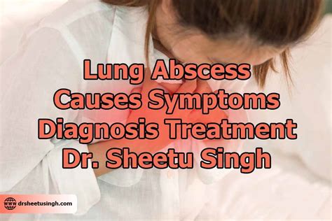 Lung Abscess - Causes, Symptoms, Diagnosis, Treatment & Consultant