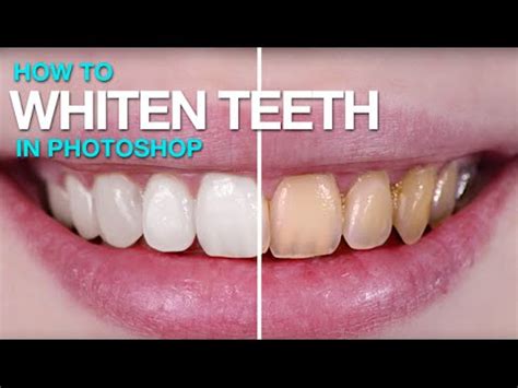 How to Whiten Teeth in Photoshop - YouTube