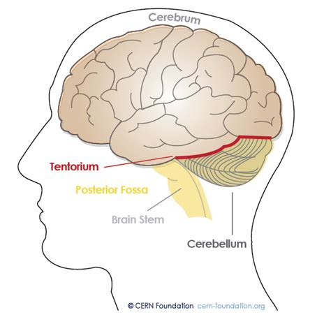 Spine and Brain Tumor and Anatomy | CERN Foundation