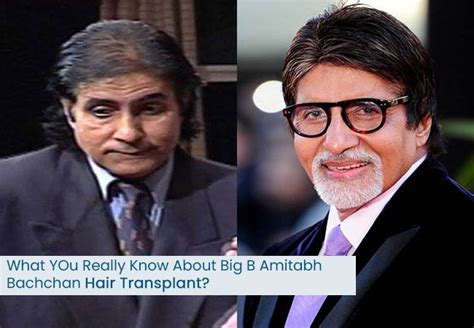 Did Amitabh Bachchan Have A Hair Transplant? Lets Find Out Big-B ...