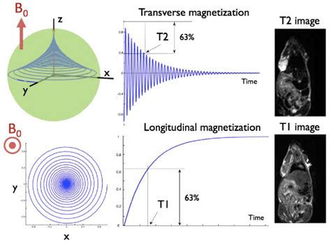 Mri T1 Intensity Chart