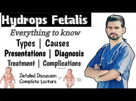 Hydrops Fetalis || causes, types, management, complications - YouTube