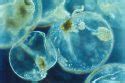 Dinoflagelados - Filo Dinophyta - Biologia - InfoEscola