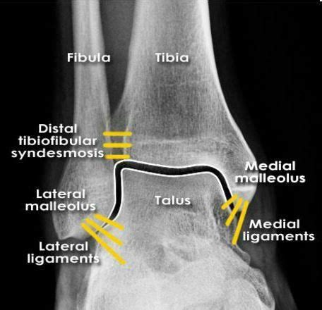 Pin by Andres Sanchez on Radiology | Radiology student, Medical radiography, Medical anatomy