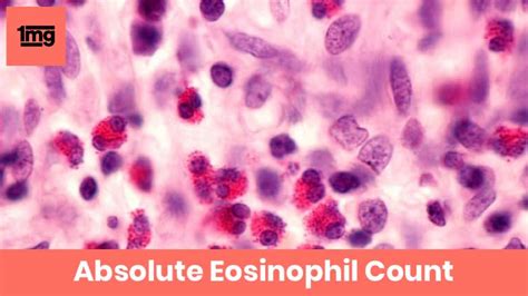 Absolute Eosinophil Count (AEC): Purpose & Normal Range of Results | 1mg