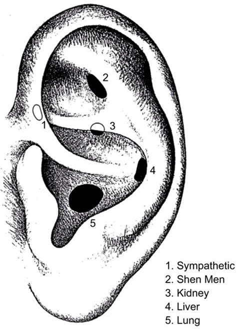 National Acupuncture Detoxification Association (NADA) Protocol. The... | Download Scientific ...