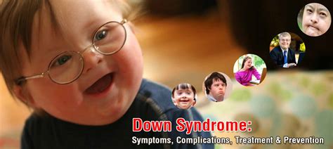 Down Syndrome: Symptoms, Complications, Treatment & Prevention-MedplusMart