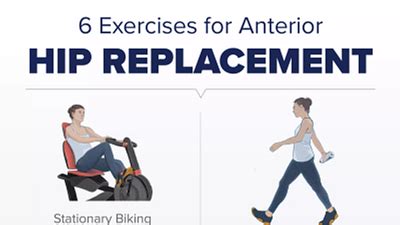 Anterior Hip Replacement Exercises Arthritis-health