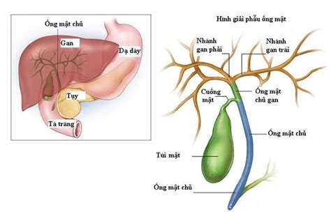 Những câu hỏi thường gặp về sỏi đường mật – Phòng Khám 108 – Bác sĩ ...