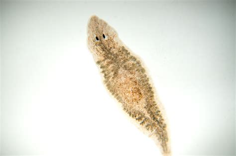 Planaria Flatworm Under Microscope View Stock Photo - Download Image Now - iStock