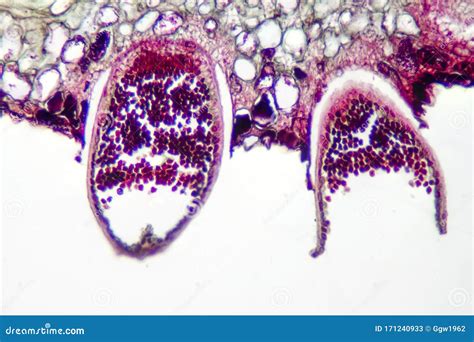 Puccinia fungi stock image. Image of biology, necrophytic - 171240933